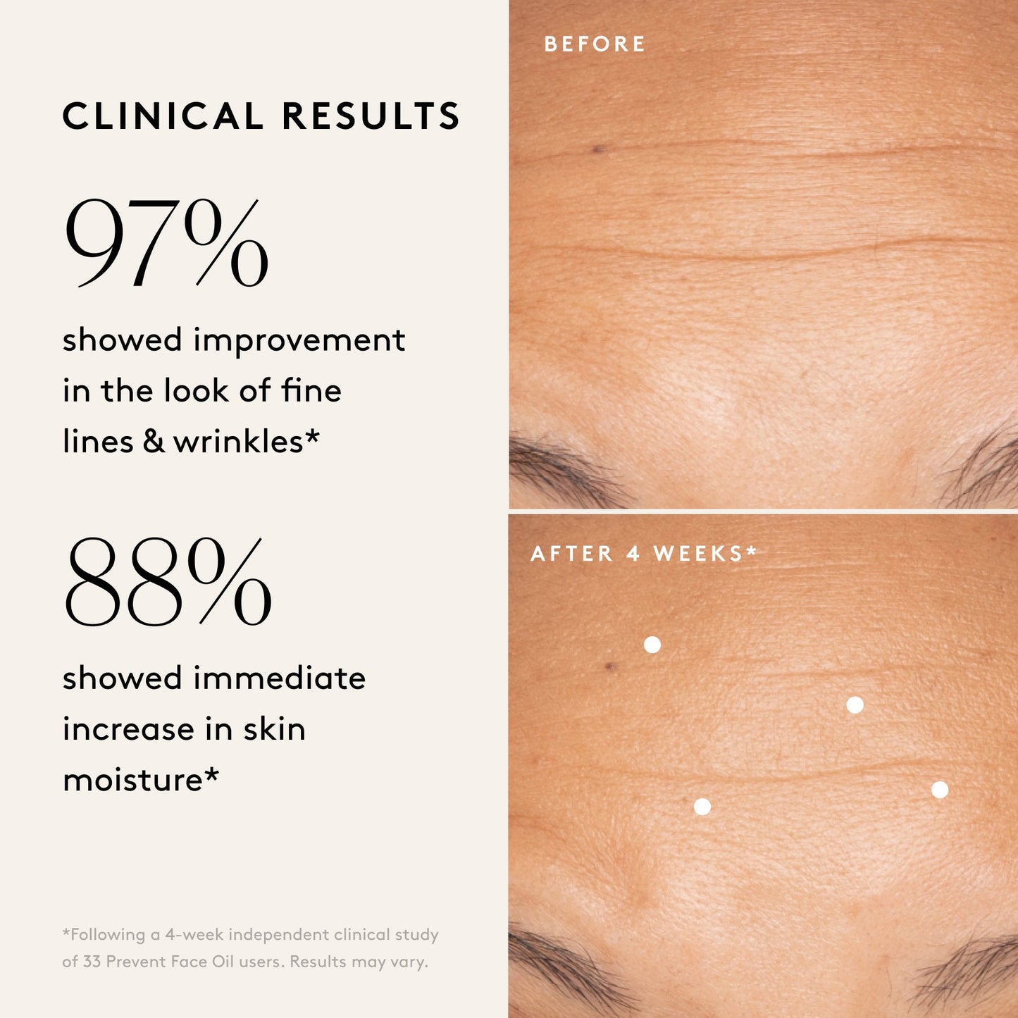 
                
                  Prevent Anti-Aging Face Oil
                
              