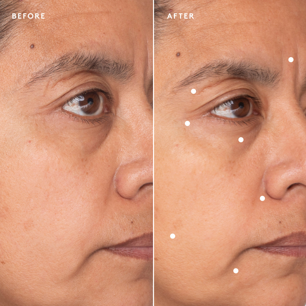 
                
                  Copia de Renew Resurfacing Night Serum (TEST)
                
              
